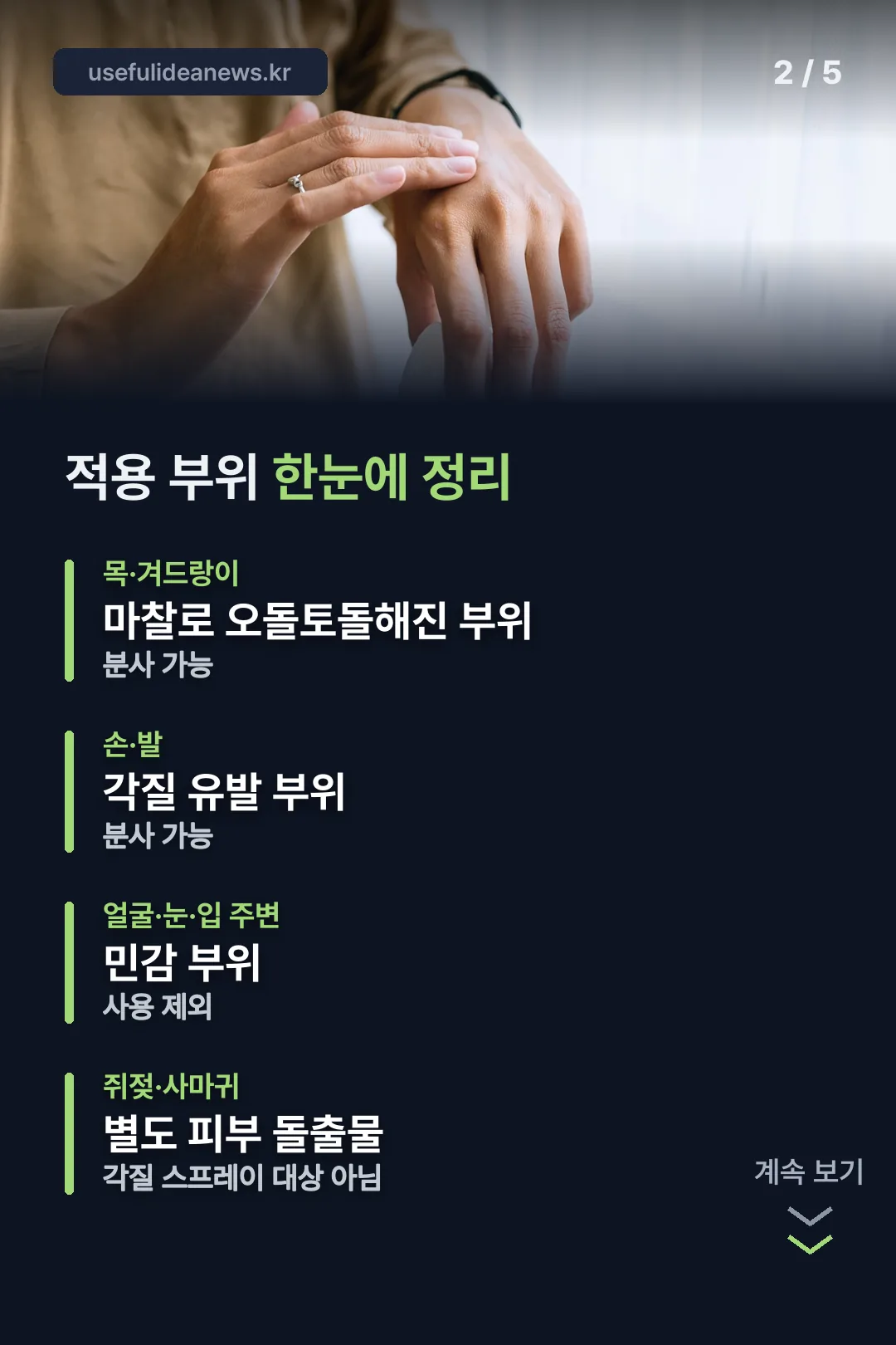 적용 부위 한눈에 정리